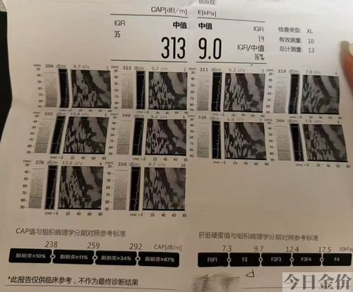 自制黄金蛋甩蛋器