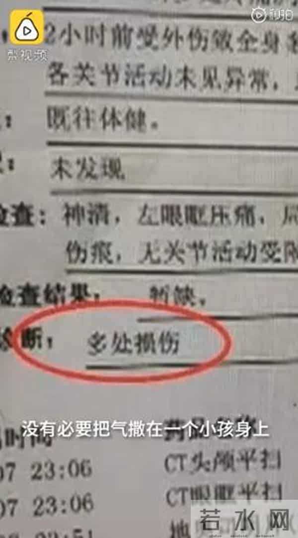 男子遭恶作剧电梯内暴打小孩