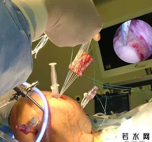 丁少华资料,发明登上国际权威杂志开创“中国疗法”，宁波这个医生厉害了