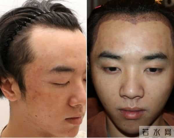 花花整容到什么程度了