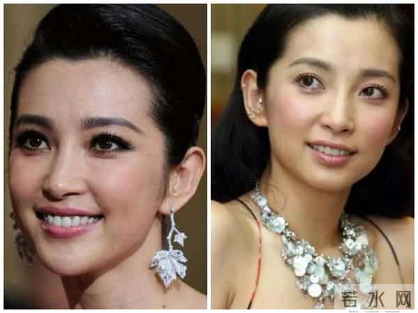 柳岩整形前后对比