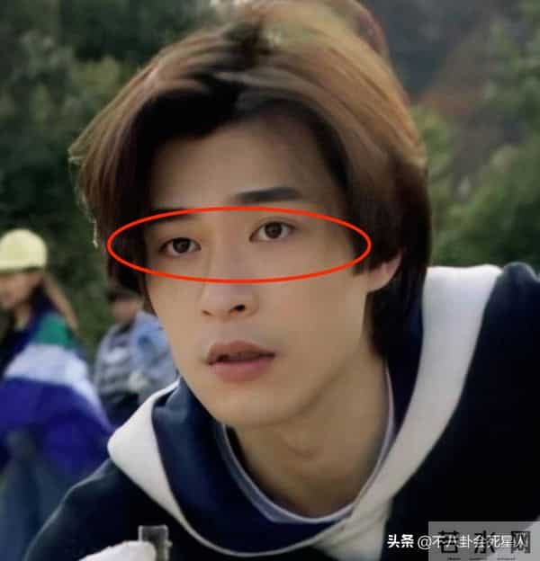 古巨基割双眼皮