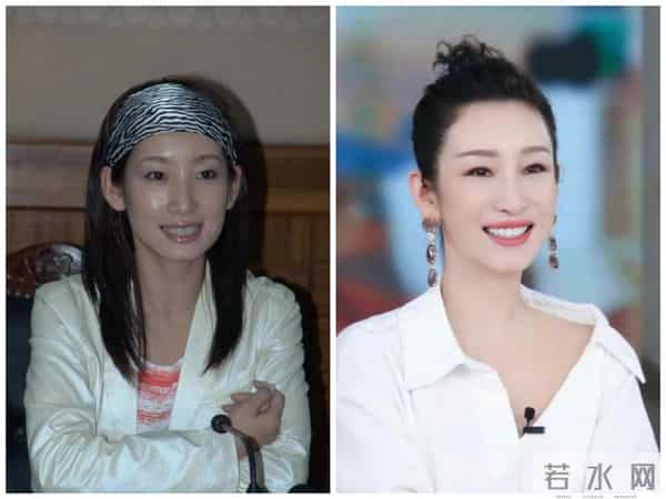 柳岩整形前后对比