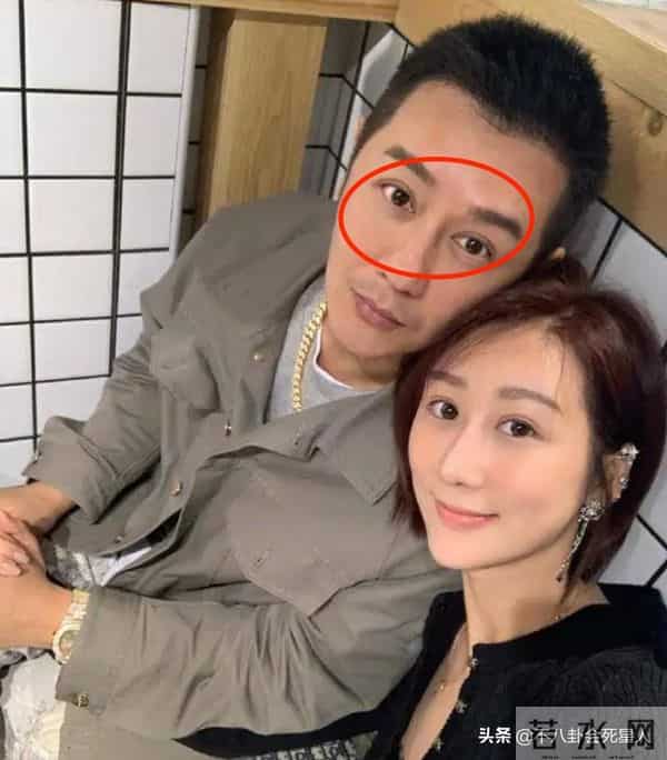 古巨基割双眼皮