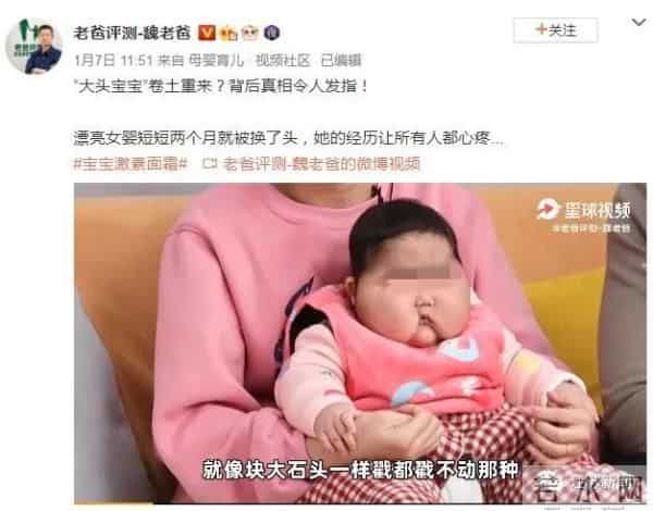 嗳婴树:5个月女婴被曝使用面霜后变“大头娃娃”,脸硬得像石头!卫健委回应
