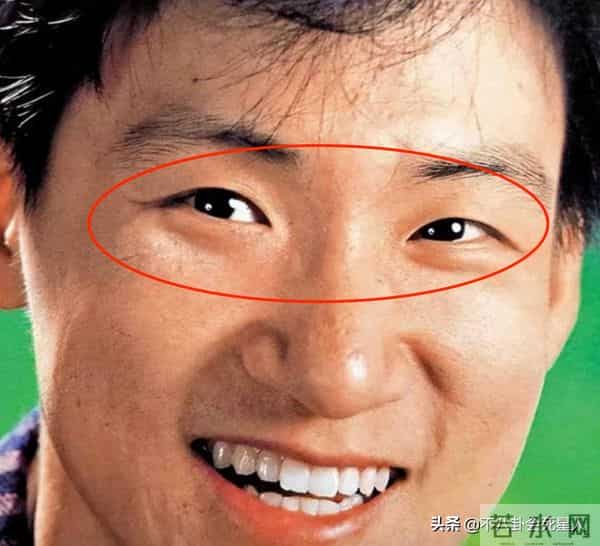 古巨基割双眼皮