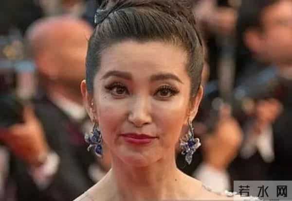 柳岩整形前后对比