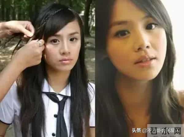 古巨基割双眼皮