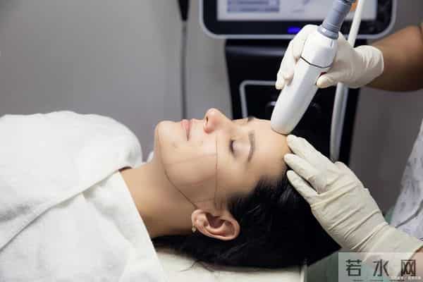 陈小纭前后对比