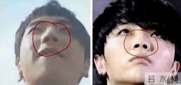 花花整容到什么程度了