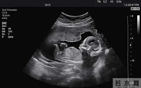 儿童照团购：孕婴摄影店拍四维宝宝照片，送粉蓝相框暗示胎儿性别？涉嫌违法！