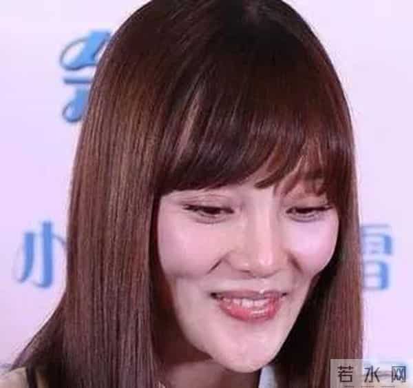 柳岩整形前后对比