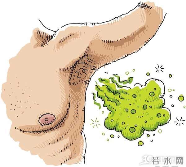 腋毛论坛：世界上80%的人有体臭，在中国却80%的人“无味”，原因何在？