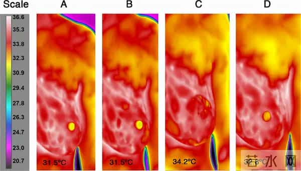 吸乳器使用说明