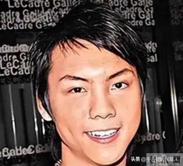 古巨基割双眼皮