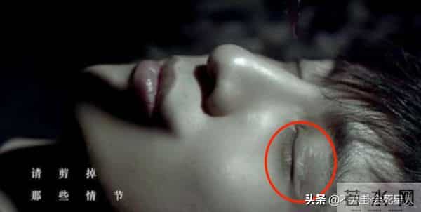 古巨基割双眼皮