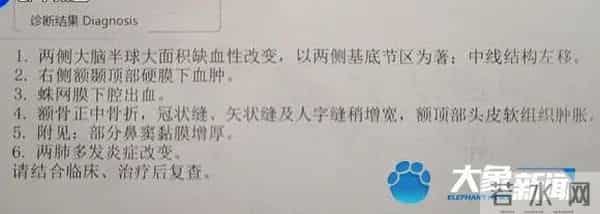 举高高把儿子摔进ICU