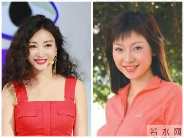 柳岩整形前后对比