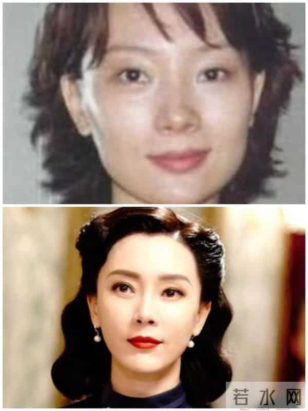 柳岩整形前后对比