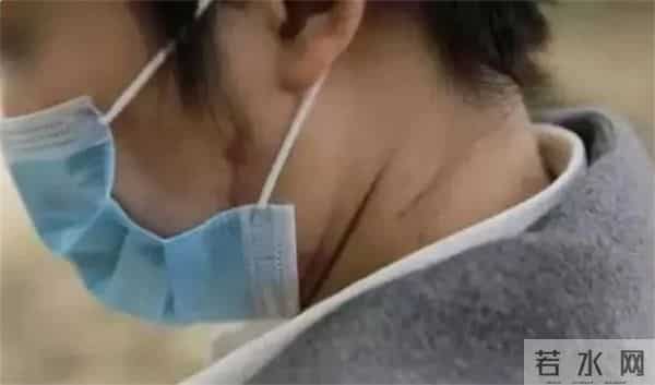 老虎伤人女主角摘口罩