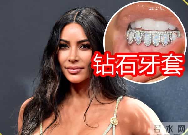 金卡戴珊钻石牙套