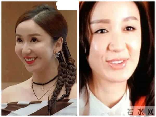 柳岩整形前后对比