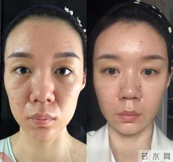 陈小纭前后对比