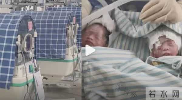 生4胞胎一家9口挤2间小卧室