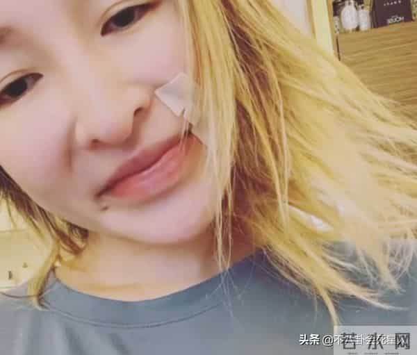 古巨基割双眼皮