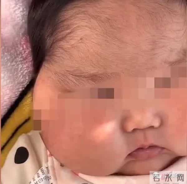嗳婴树:5个月女婴被曝使用面霜后变“大头娃娃”,脸硬得像石头!卫健委回应
