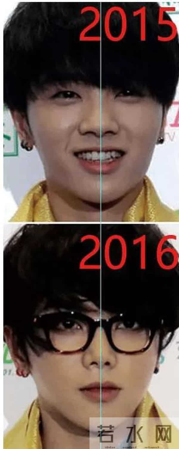 花花整容到什么程度了