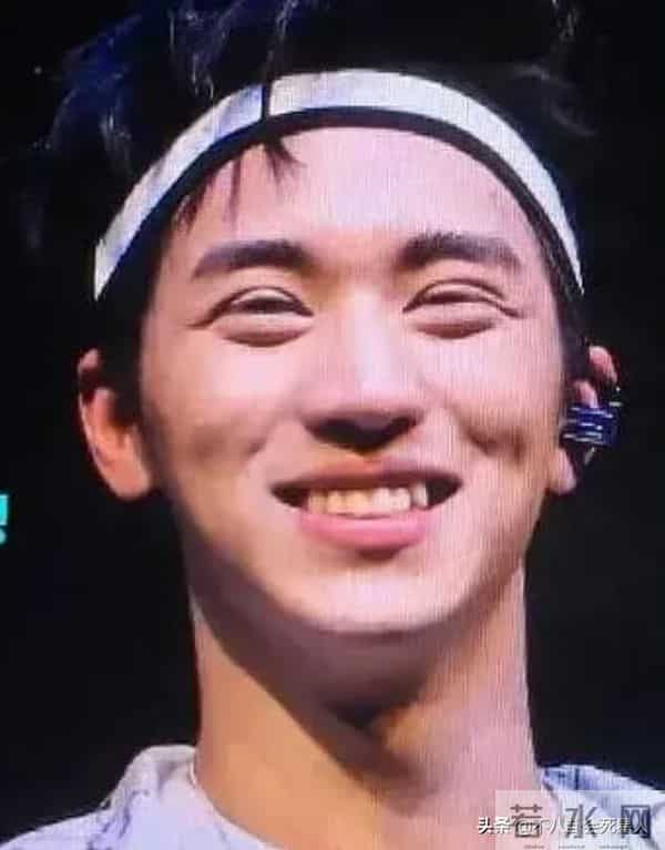 古巨基割双眼皮