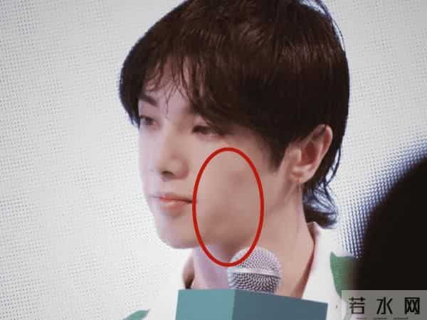 花花整容到什么程度了