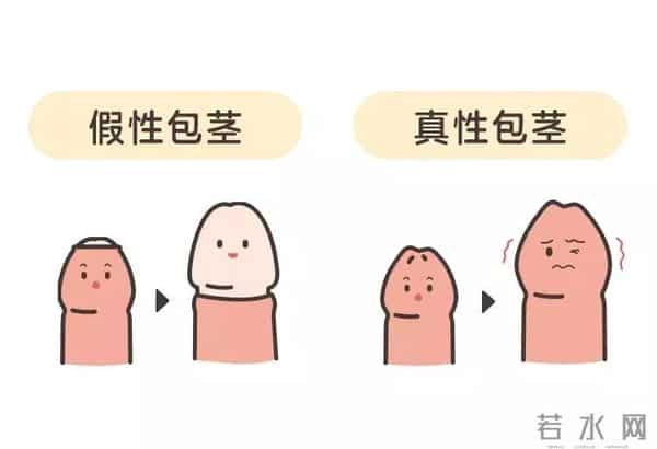 小JJ：男宝私处说明书：包皮、蛋蛋、小 JJ，这些问题必须得知道