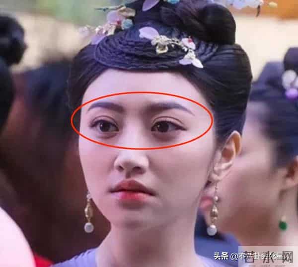 古巨基割双眼皮