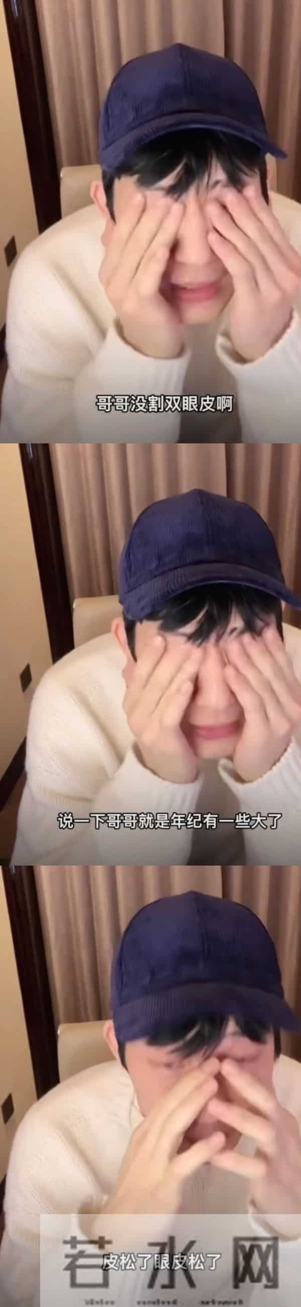 井柏然双眼皮是割的吗