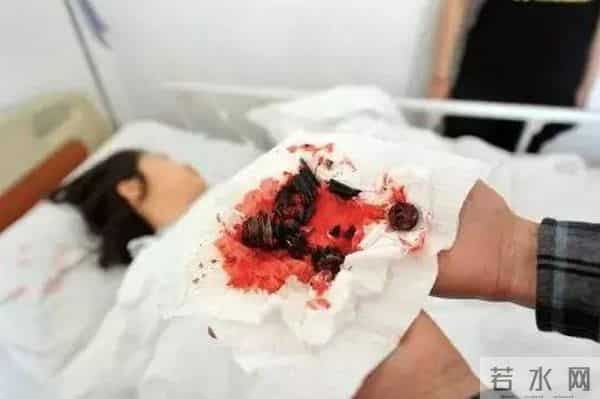 升降椅爆炸:你坐的那张椅子,随时可能爆炸!有人被炸飞!赶紧自查