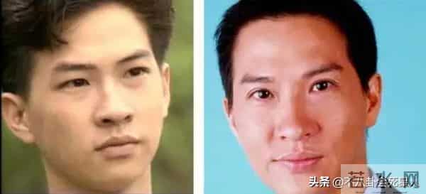 古巨基割双眼皮