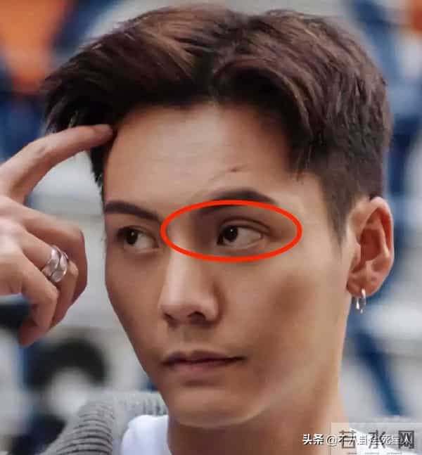 古巨基割双眼皮