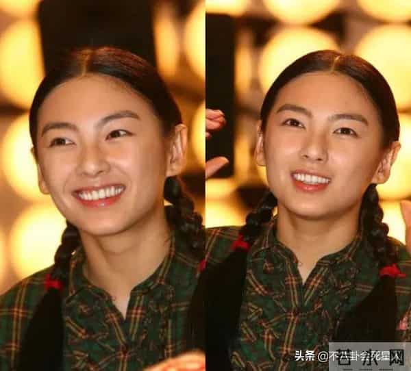 古巨基割双眼皮