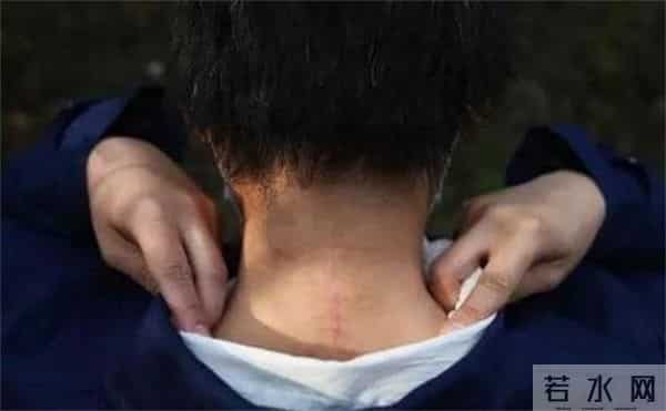 老虎伤人女主角摘口罩