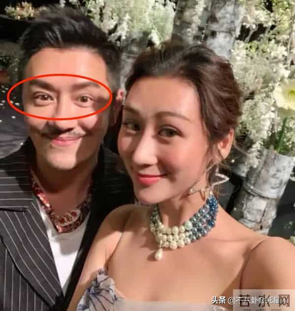 古巨基割双眼皮