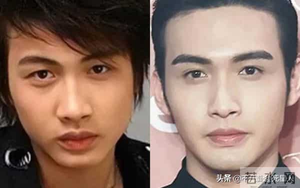 古巨基割双眼皮