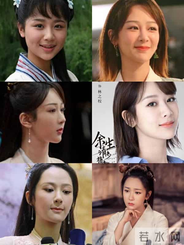 柳岩整形前后对比