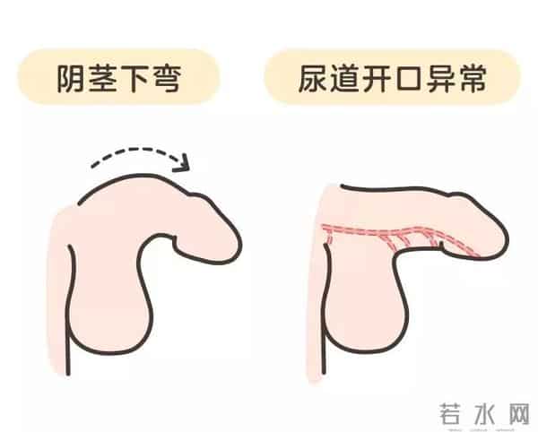 小JJ：男宝私处说明书：包皮、蛋蛋、小 JJ，这些问题必须得知道