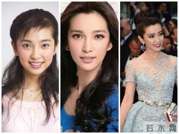 柳岩整形前后对比