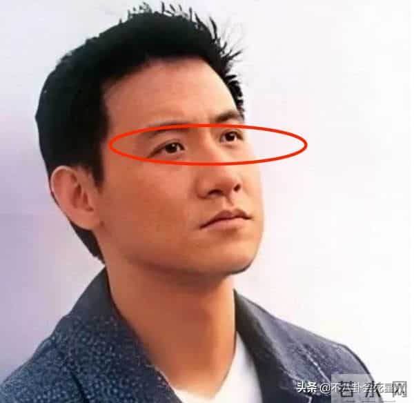 古巨基割双眼皮