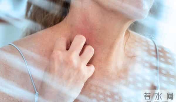 无花果有禁忌,这5类人或要少碰,还不知道的建议了解