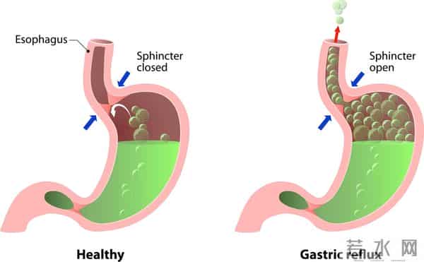 喝柠檬水，6大好处找上你，医生：3类人不要喝，会伤身