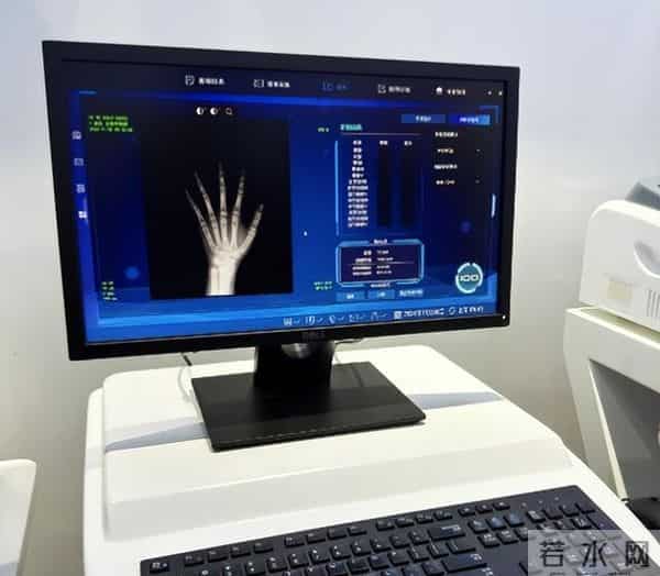 女孩来月经时,骨龄身高达到这个标准,长高就不用发愁了